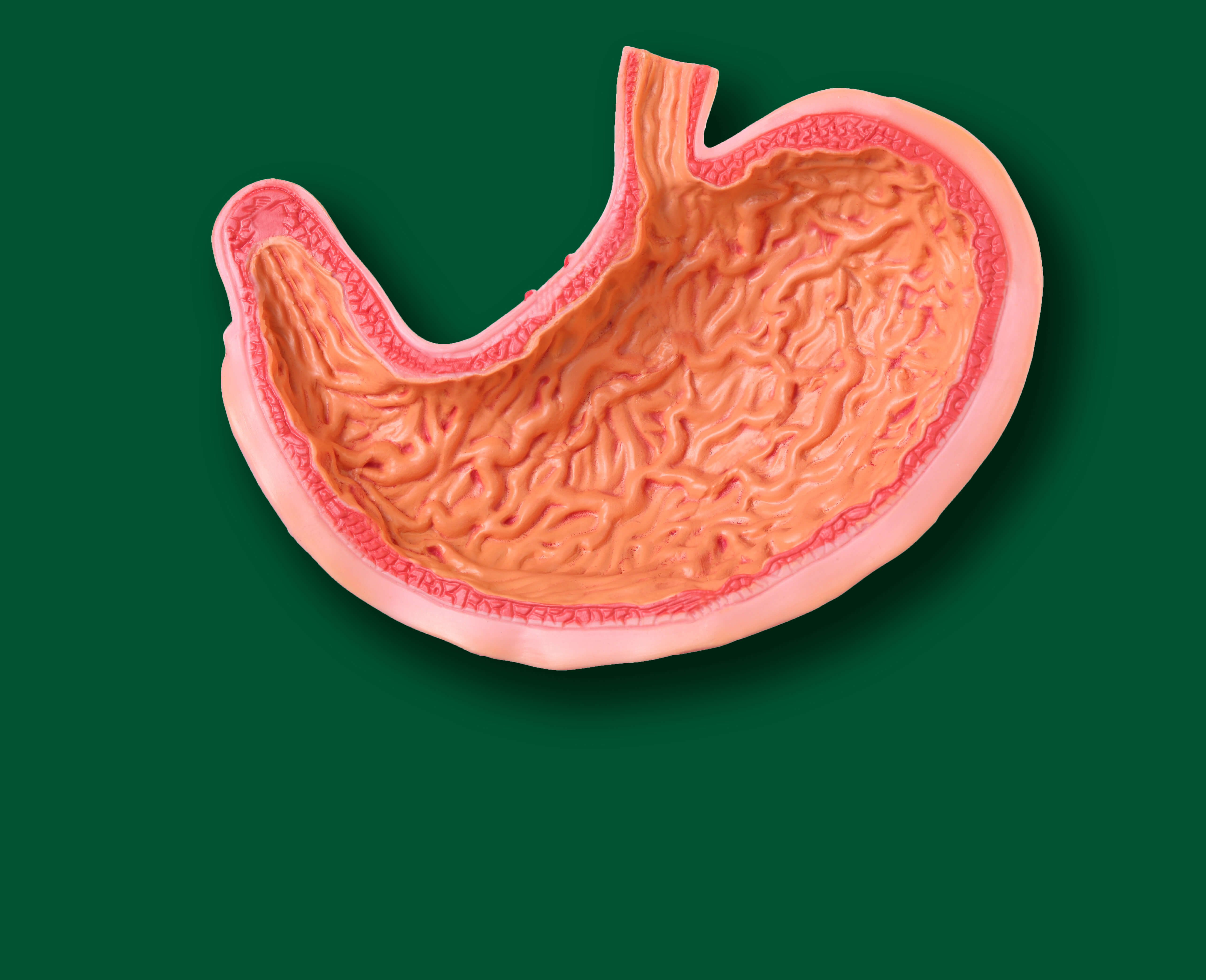 Der Magen speichert Nahrung vorübergehend und gibt sie zur Verdauung an den Darm weiter. 